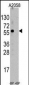 HSC70 Interacting Protein HIP (ST13) Antibody