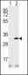 CD82 (ST6) Antibody (C-term)