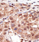 MTM1 Antibody (N-term)