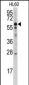 MTM1 Antibody (N-term)