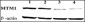 MTM1 Antibody (C-term)