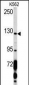 PDGFRA Antibody (C-term E1063)