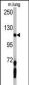 PDGFRA Antibody (C-term E1063)