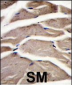 Fructose 6 Phosphate Kinase (PFKM) Antibody (C-term)