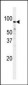 Fructose 6 Phosphate Kinase (PFKM) Antibody (C-term)