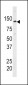 HK1 Antibody (C-term)