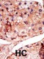 PFKFB2 Antibody (N-term)