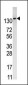 PFKFB2 Antibody (N-term)