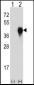 PLAUR Antibody (Center)