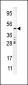 Urokinase (PLAU) Antibody (C-term)