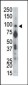 PTP alpha Antibody (N-term)