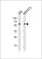 BMPR1A Antibody (Center C180)