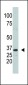 SULT1A1 Antibody (Center)