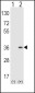 SULT1A1 Antibody (Center)