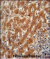 Pyruvate Kinase (PKM2) Antibody (C-term)