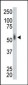 MNK2 (MKNK2) Antibody (N-term)