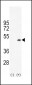 Creatine Kinase B Antibody (C-term)