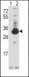 Ketohexokinase (KHK) Antibody (N-term)