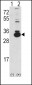 Ketohexokinase (KHK) Antibody (C-term)