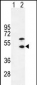 CKM Antibody (N-term)