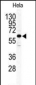 ILK2/ILK1 Antibody (C-term)