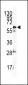 ILK2/ILK1 Antibody (C-term)