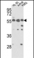 PICK1 (PRKCABP) Antibody (C-term)