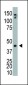 ADK Antibody (N-term)