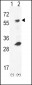 GCK Antibody (C-term)