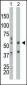 PKR (PRKR) Antibody (N-term)