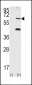 PKR (PRKR) Antibody (N-term)