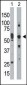 PKR (PRKR) Antibody (C-term)