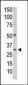 PP1C gamma (PPP1CC) Antibody (N-term)