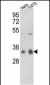PP1C gamma (PPP1CC) Antibody (C-term)