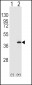 Protein Phosphatase 1 beta (PPP1CB) Antibody (C-term)