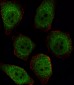 Protein Phosphatase 1 beta (PPP1CB) Antibody (C-term)