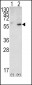 PTEN Antibody (N-term)