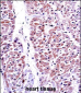 PTEN Antibody (C-term F279)