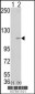 LSD1 Antibody (Center)