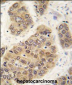 SUMO4 Antibody (M55 Wild type)