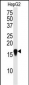 SUMO4 Antibody (M55 Wild type)