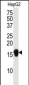 SUMO4 Antibody (V55 Mutant)