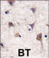 LC3 Antibody (APG8A) (N-term)