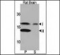 LC3 Antibody (APG8A) (N-term)