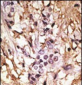 LC3 Antibody (APG8B) (C-term)