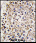 LC3 Antibody (APG8B) (C-term)