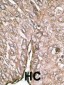 LC3 Antibody (APG8A/B)