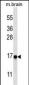 Cleaved LC3A Antibody