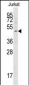 ATG4A Antibody