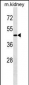 ATG4A Antibody